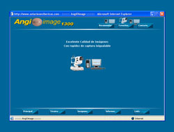 Angio Image